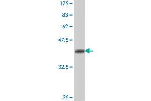 Western Blot detection against Immunogen (38. (CHRNB4 antibody  (AA 68-177))