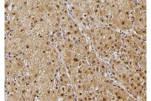 ABIN6274503 at 1/100 staining Human liver tissue by IHC-P. (ILKAP antibody  (N-Term))