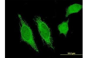 Immunofluorescence of monoclonal antibody to HHLA3 on HeLa cell. (HHLA3 antibody  (AA 1-53))
