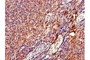 Immunohistochemistry of paraffin-embedded human lymph node tissue using ABIN7149671 at dilution of 1:100 (DENND1C antibody  (AA 601-801))