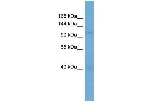 WB Suggested Anti-RANBP5  Antibody Titration: 0. (Importin 5 antibody  (N-Term))