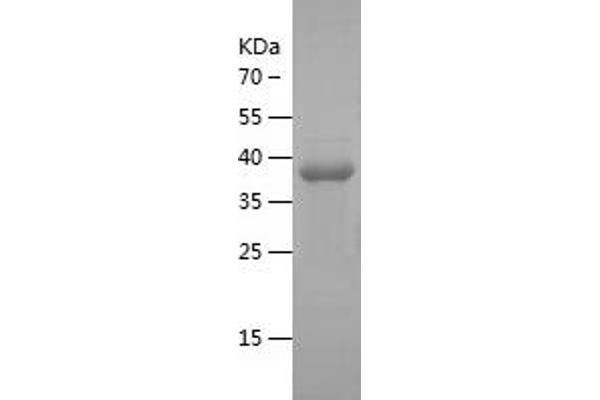 NBL1 Protein (AA 17-181) (His-IF2DI Tag)