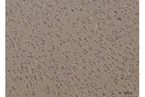 IHC analysis of Calnexin/CANX using anti-Calnexin/CANX antibody (ABIN7602289).