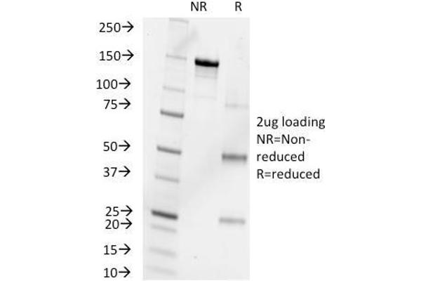 Progesterone antibody