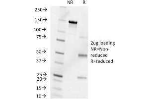 SDS-PAGE Analysis Purified Progesterone Mouse Monoclonal Antibody (6-5E-10B). (Progesterone antibody)