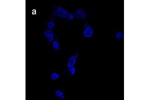 Detection of cathepsin B (CB) activity in Eca-109 cells by the CB probe. (Goat anti-Rabbit IgG Antibody (FITC))