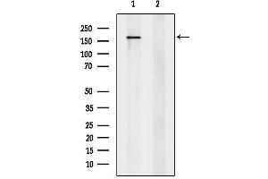 anti-TBC1 Domain Family, Member 4 (TBC1D4) (pSer588) antibody