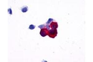 Anti-NPY5R antibody immunocytochemistry (ICC) staining of HEK293 human embryonic kidney cells transfected with NPY5R.