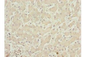 Immunohistochemistry of paraffin-embedded human liver tissue using ABIN7158391 at dilution of 1:100