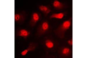 Immunofluorescent analysis of STAT1 (pS727) staining in NIH3T3 cells.