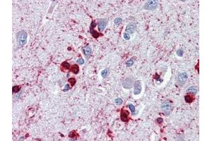 Brain, cortex, Human: Formalin-Fixed, Paraffin-Embedded (FFPE) (CRYAB antibody  (C-Term))