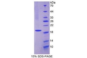 SDS-PAGE (SDS) image for Myeloperoxidase (MPO) (AA 134-263) protein (His tag) (ABIN1980788) (Myeloperoxidase Protein (MPO) (AA 134-263) (His tag))
