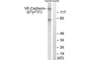 Western blot analysis of extracts from HepG2 cells treated with Na3VO4 0. (Cadherin 5 antibody  (pTyr731))