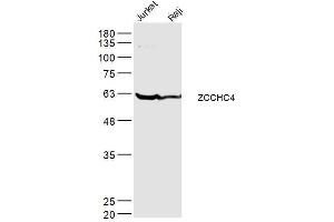 Lane 1: jurkat lysates Lane 2: raji lysates probed with ZCCHC4 Polyclonal Antibody, Unconjugated  at 1:300 dilution and 4˚C overnight incubation. (ZCCHC4 antibody  (AA 301-400))