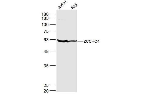 ZCCHC4 antibody  (AA 301-400)