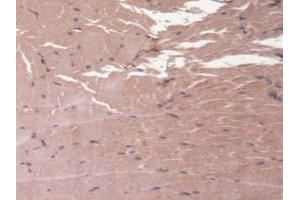 Detection of HMWK in Mouse Skeletal Muscle Tissue using Polyclonal Antibody to High Molecular Weight Kininogen (HMWK) (Kininogen (HMW) antibody  (AA 268-540))