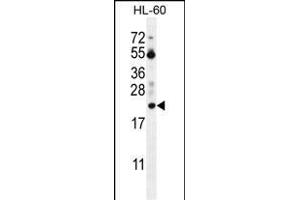 PT Antibody (N-term) (ABIN655715 and ABIN2845165) western blot analysis in HL-60 cell line lysates (35 μg/lane). (PTMA antibody  (N-Term))