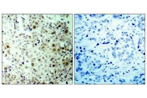 Immunohistochemistry (IHC) image for anti-Cyclin-Dependent Kinase 2 (CDK2) (pThr160) antibody (ABIN7138780)