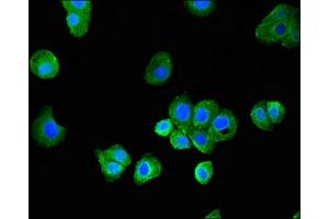 Immunofluorescent analysis of HepG2 cells using ABIN7159786 at dilution of 1:100 and Alexa Fluor 488-congugated AffiniPure Goat Anti-Rabbit IgG(H+L) (LC3C antibody  (AA 1-30))