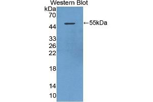 Detection of Recombinant DAPK3, Mouse using Polyclonal Antibody to Death Associated Protein Kinase 3 (DAPK3) (DAPK3 antibody  (AA 1-448))