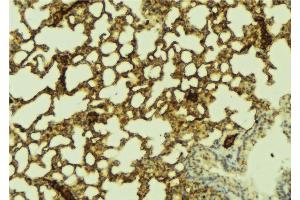 ABIN6269338 at 1/100 staining Mouse lung tissue by IHC-P. (FOXO1 antibody  (Internal Region))