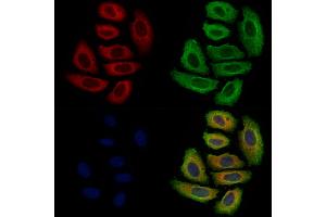 ABIN7094863 and ABIN7098915 staining Hela cells by IF/ICC. (p40 (p63 Delta) (Internal Region) antibody)