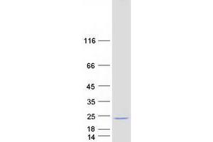 Validation with Western Blot (JOSD2 Protein (Myc-DYKDDDDK Tag))