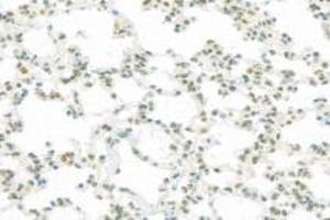 Immunohistochemistry (Paraffin-embedded Sections) (IHC (p)) image for anti-RNA Polymerase II Associated Protein 2 (RPAP2) antibody (ABIN7075481)