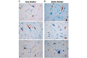 Representative images of collagen IV (brown) and GPR39 (blue) (ABIN1048812) labeling in human dlPFC grey, C, and white matter, D, arrows indicate colocalization of GPR39 with collagen IV, arrowheads indicate close proximity of GPR39 with collagen IV. (GPR39 antibody  (Extracellular Domain))