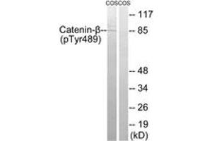Western blot analysis of extracts from COS7 cells treated with UV 15', using Catenin-beta (Phospho-Tyr489) Antibody. (beta Catenin antibody  (pTyr489))
