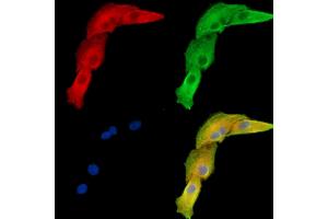 ABIN7096019 and ABIN7100081 staining  cells by IF/ICC. (GALNT2 antibody)