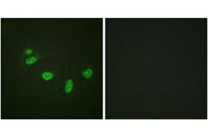 Immunofluorescence analysis of HeLa cells, using ETS1 (Phospho-Thr38) Antibody. (ETS1 antibody  (pThr38))