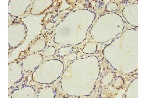 Immunohistochemistry of paraffin-embedded human thyroid tissue using ABIN7142322 at dilution of 1:100