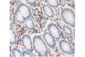 IHC-P analysis of Human Stomach Tissue, with DAB staining. (TNF alpha antibody  (AA 77-233))