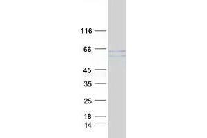 Western Blotting (WB) image for Myocyte Enhancer Factor 2A (MEF2A) (Transcript Variant 1) protein (Myc-DYKDDDDK Tag) (ABIN2725757)