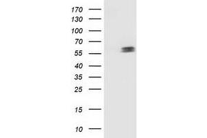 Western Blotting (WB) image for anti-Tumor Protein P53 (TP53) antibody (ABIN1499970) (p53 antibody)
