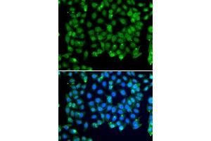 Immunofluorescence analysis of MCF-7 cells using RNF8 antibody (ABIN6128649, ABIN6147049, ABIN6147051 and ABIN6218319). (RNF8 antibody  (AA 1-260))