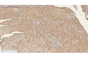Immunohistochemistry of paraffin-embedded Mouse heart tissue using ENO2 Monoclonal Antibody at dilution of 1:200. (ENO2/NSE antibody)