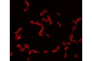 ABIN6274983 staining A549 by IF/ICC. (CGREF1 antibody  (C-Term))
