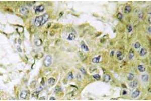 Immunohistochemistry (IHC) analyzes of Casein Kinase Igamma1 antibody in paraffin-embedded human brain tissue. (CSNK1G1 antibody)