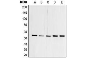 Western blot analysis of TFDP1 expression in HEK293T (A), A431 (B), Raji (C), mouse heart (D), PC12 (E) whole cell lysates. (DP1 antibody  (C-Term))