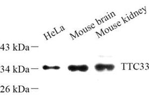 Western blot analysis of TTC33 (ABIN7075871) at dilution of 1: 500 (TTC33 antibody)