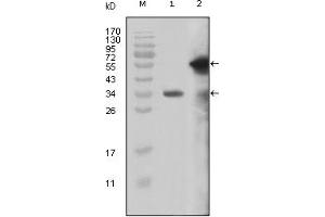 Western Blotting (WB) image for anti-Myeloid/lymphoid Or Mixed-Lineage Leukemia (MLL) (AA 3751-3968) antibody (ABIN2464083) (MLL/KMT2A antibody  (AA 3751-3968))