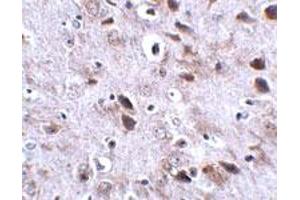 Immunohistochemical staining of mouse brain tissue with 2. (Transmembrane Protein 18 (TMM18) (C-Term) antibody)