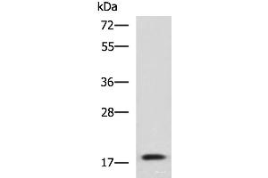 Western blot analysis of Human fetal liver tissue lysate using IL1B Polyclonal Antibody at dilution of 1:800 (IL-1 beta antibody)