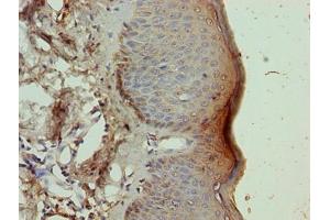 Immunohistochemistry of paraffin-embedded human skin tissue using ABIN7161852 at dilution of 1:100 (NR2C2AP antibody  (AA 7-139))