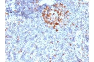 Formalin-fixed, paraffin-embedded human Tonsil stained with Cdk1 Mouse Monoclonal Antibody (A17. (CDK1 antibody  (C-Term))