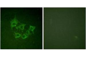 Immunofluorescence analysis of HuvEc cells, using COT (Phospho-Thr290) Antibody. (CROT antibody  (pThr290))