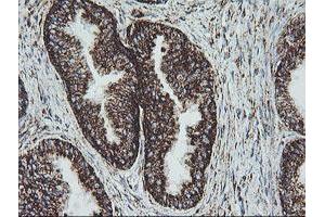 Image no. 1 for anti-NADH Dehydrogenase (Ubiquinone) 1 beta Subcomplex, 10, 22kDa (NDUFB10) antibody (ABIN1499669) (NDUFB10 antibody)