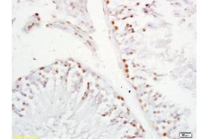 Formalin-fixed and paraffin embedded rat testis labeled with Anti-XAGE2 Polyclonal Antibody, Unconjugated (ABIN721750) at 1:200 followed by conjugation to the secondary antibody and DAB staining.